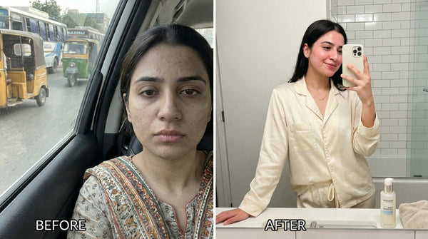 1 face wash Before & After