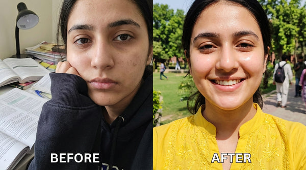 4 Face Care before & after