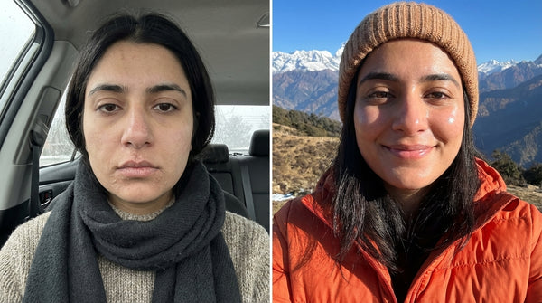 face wash for dry skin 4 before & after